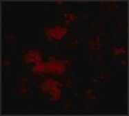 Anti-STIM2 (ab2) antibody produced in rabbit affinity isolated antibody, buffered aqueous solution