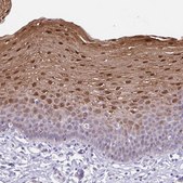 Anti-TGM3 antibody produced in rabbit Prestige Antibodies® Powered by Atlas Antibodies, affinity isolated antibody, buffered aqueous glycerol solution
