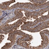 Anti-CDK5RAP3 antibody produced in rabbit Prestige Antibodies® Powered by Atlas Antibodies, affinity isolated antibody, buffered aqueous glycerol solution