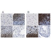 Anti-MS4A1 antibody produced in rabbit Prestige Antibodies® Powered by Atlas Antibodies, affinity isolated antibody, buffered aqueous glycerol solution
