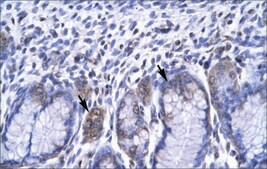 Anti-RBPJ antibody produced in rabbit affinity isolated antibody