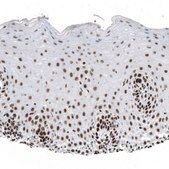 Monoclonal Anti-SETD2 antibody produced in mouse Prestige Antibodies® Powered by Atlas Antibodies, clone CL9956, purified immunoglobulin, buffered aqueous glycerol solution