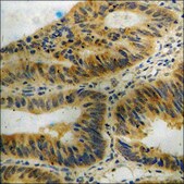 Anti-phospho-eIF2 α (pSer51) antibody produced in rabbit affinity isolated antibody