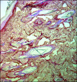 单克隆抗-胶原蛋白，III型 小鼠抗 clone FH-7A, ascites fluid