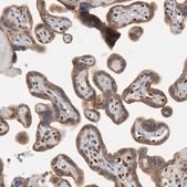 Anti-FOXO1 antibody produced in rabbit Prestige Antibodies® Powered by Atlas Antibodies, affinity isolated antibody, buffered aqueous glycerol solution