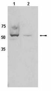 抗CYP450抗体，克隆2E1 serum, Chemicon&#174;