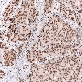 Monoclonal Anti-Smarcb1 Antibody Produced In Mouse Prestige Antibodies® Powered by Atlas Antibodies, clone CL13973, affinity isolated antibody, buffered aqueous glycerol solution