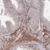 Anti-SH3PXD2A antibody produced in rabbit Prestige Antibodies® Powered by Atlas Antibodies, affinity isolated antibody, buffered aqueous glycerol solution