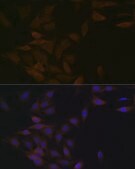 Anti-PP2A alpha + beta antibody produced in rabbit