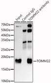 Anti-TOMM22 Antibody, clone 6R1L7, Rabbit Monoclonal