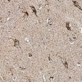 抗-HSPA9 兔抗 Prestige Antibodies® Powered by Atlas Antibodies, affinity isolated antibody, buffered aqueous glycerol solution