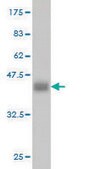 Monoclonal Anti-ADH4 antibody produced in mouse clone 3C5, purified immunoglobulin, buffered aqueous solution