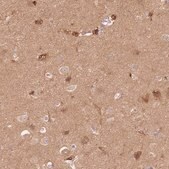 Anti-STK39 antibody produced in rabbit Prestige Antibodies® Powered by Atlas Antibodies, affinity isolated antibody, buffered aqueous glycerol solution