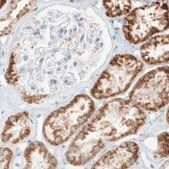 Monoclonal Anti-SDHB antibody produced in mouse Prestige Antibodies® Powered by Atlas Antibodies, clone CL0346, purified immunoglobulin, buffered aqueous glycerol solution