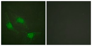 Anti-p53 antibody produced in rabbit affinity isolated antibody