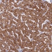 Anti-MMAB antibody produced in rabbit Prestige Antibodies® Powered by Atlas Antibodies, affinity isolated antibody, buffered aqueous glycerol solution