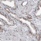 Anti-BMI1 antibody produced in rabbit Prestige Antibodies® Powered by Atlas Antibodies, affinity isolated antibody, buffered aqueous glycerol solution