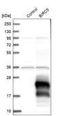 Anti-BIRC5 antibody produced in rabbit Prestige Antibodies® Powered by Atlas Antibodies, affinity isolated antibody, buffered aqueous glycerol solution