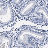 抗-AKAP4 兔抗 Prestige Antibodies® Powered by Atlas Antibodies, affinity isolated antibody, buffered aqueous glycerol solution