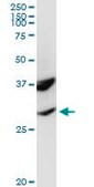 Anti-POMC antibody produced in rabbit purified immunoglobulin, buffered aqueous solution