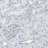 Anti-ME1 antibody produced in rabbit Prestige Antibodies® Powered by Atlas Antibodies, affinity isolated antibody, buffered aqueous glycerol solution