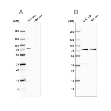 Anti-OPTN antibody produced in rabbit Ab1, Prestige Antibodies® Powered by Atlas Antibodies, affinity isolated antibody, buffered aqueous glycerol solution