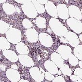 抗-MKI67 兔抗 Ab2, Prestige Antibodies® Powered by Atlas Antibodies, affinity isolated antibody, buffered aqueous glycerol solution