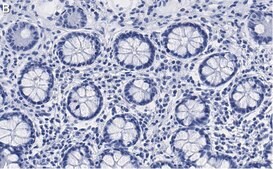 Anti-PSMB2 Antibody, clone 2N18 ZooMAb® Rabbit Monoclonal recombinant, expressed in HEK 293 cells