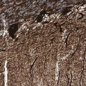 抗-INA 兔抗 Prestige Antibodies® Powered by Atlas Antibodies, affinity isolated antibody, buffered aqueous glycerol solution