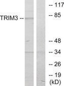 Anti-TRIM3 antibody produced in rabbit affinity isolated antibody