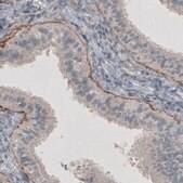 Monoclonal Anti-LAMC1 antibody produced in mouse Prestige Antibodies® Powered by Atlas Antibodies, clone CL3195, purified immunoglobulin, buffered aqueous glycerol solution
