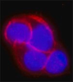 Anti-EpCAM antibody, Mouse monoclonal clone Ber-EP4, purified from hybridoma cell culture