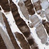 Anti-PHKG1 antibody produced in rabbit Prestige Antibodies® Powered by Atlas Antibodies, affinity isolated antibody, buffered aqueous glycerol solution