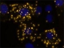 Duolink® In Situ Orange Starter Kit Mouse/Goat