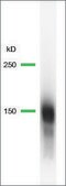 Anti-EGFR antibody, Rabbit monoclonal clone SP84, recombinant, expressed in proprietary host, affinity isolated antibody