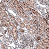 Monoclonal Anti-LAPTM4B antibody produced in mouse Prestige Antibodies® Powered by Atlas Antibodies, clone CL5289, purified immunoglobulin, buffered aqueous glycerol solution