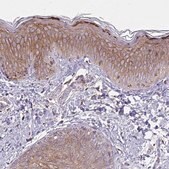 Anti-SPTBN2 antibody produced in rabbit Prestige Antibodies® Powered by Atlas Antibodies, affinity isolated antibody, buffered aqueous glycerol solution