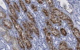 Anti-Aquaporin-1 Antibody, clone 2I7 ZooMAb® Rabbit Monoclonal recombinant, expressed in HEK 293 cells