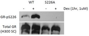 Anti-phospho-Glucocorticoid receptor Antibody, Ser226 from rabbit, purified by affinity chromatography