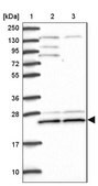 Anti-TRIM3 antibody produced in rabbit Prestige Antibodies® Powered by Atlas Antibodies, affinity isolated antibody, buffered aqueous glycerol solution