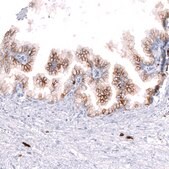Monoclonal Anti-CD38 antibody produced in mouse Prestige Antibodies® Powered by Atlas Antibodies, clone CL15572, purified antibody (Protein A)