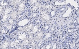 Anti-Erythropoietin Antibody, clone 6E5, ZooMAb® Rabbit Monoclonal recombinant, expressed in HEK 293 cells