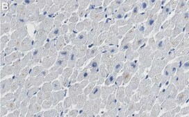 Anti-NDUFB8 Antibody, clone 1E7 ZooMAb® Rabbit Monoclonal recombinant, expressed in HEK 293 cells