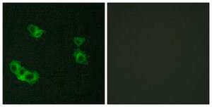 Anti-PTHR1 antibody produced in rabbit affinity isolated antibody