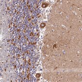 Anti-VDAC2 antibody produced in rabbit Prestige Antibodies® Powered by Atlas Antibodies, affinity isolated antibody, buffered aqueous glycerol solution