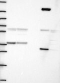 Anti-SMN1 antibody produced in rabbit Prestige Antibodies® Powered by Atlas Antibodies, affinity isolated antibody, buffered aqueous glycerol solution