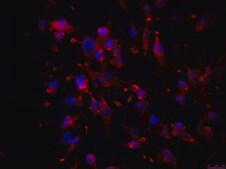 OSUMMER.11 Mouse NRAS-Mutant Melanoma Cell Line