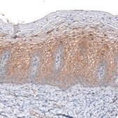 Monoclonal Anti-CLIP1 antibody produced in mouse Prestige Antibodies® Powered by Atlas Antibodies, clone CL4844, purified immunoglobulin, buffered aqueous glycerol solution