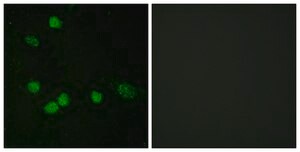 Anti-C-RAF, C-Terminal antibody produced in rabbit affinity isolated antibody