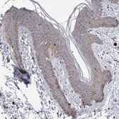 Anti-FAM83H antibody produced in rabbit Prestige Antibodies® Powered by Atlas Antibodies, affinity isolated antibody, buffered aqueous glycerol solution, Ab1
